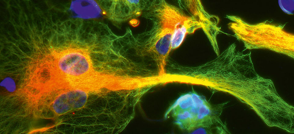 Zellen, die mit fluoreszierenden Farbstoffen markiert wurden, unter dem Mikroskop